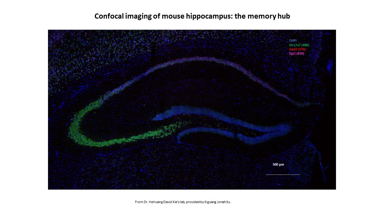 Confocal image of mouse hippocampus: the memory hub.   Image from the lab of Dr. Hehuang David Xie, courtesy of Xiguang Jonah Xu.    