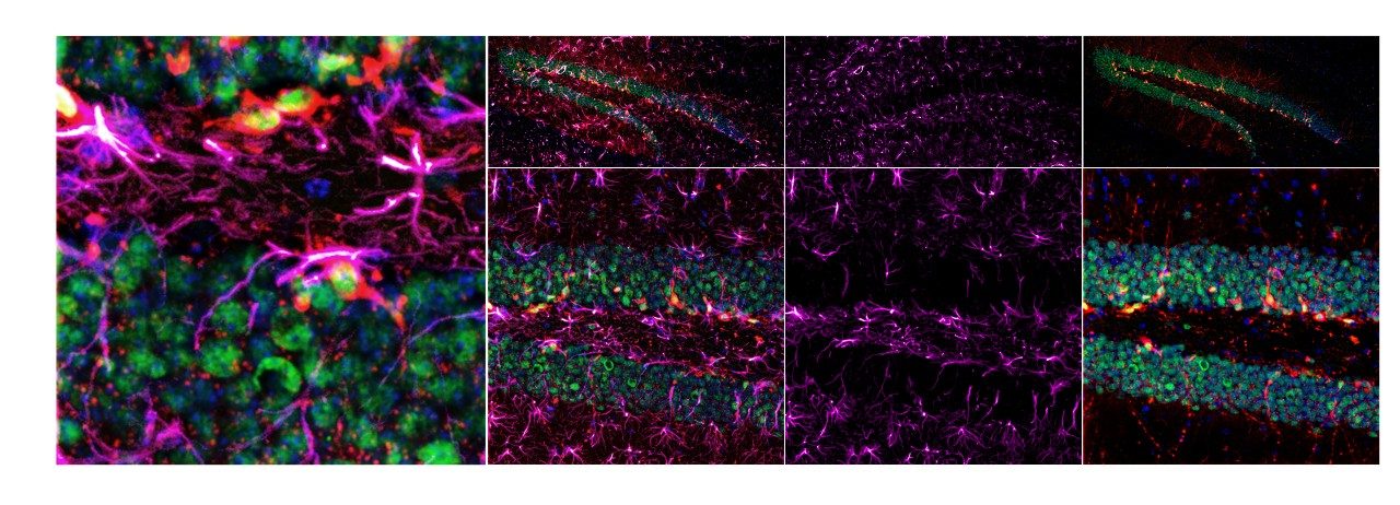 Neurogenesis and astrogliosis in the mouse dentate gyrus of the hippocampus   Images courtesy of Michelle Theus, VT 
